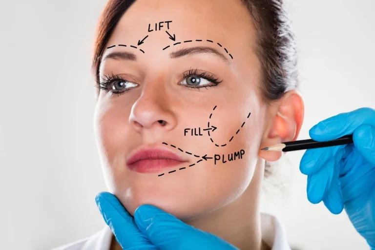 What Makes Dubai a Top Choice for Facelift Procedures?